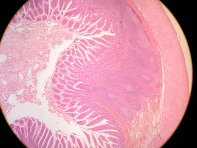 ileum histology labeled peyers patches