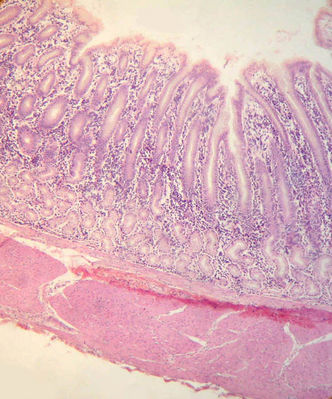 Stomach Histology - Stomach - histology slide