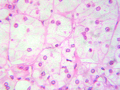 Adrenal Gland Histology - Adrenal gland, zona glomerulosa - histology