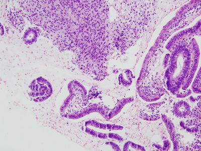 Uterus Histology - Proliferative endometrium - histology slide