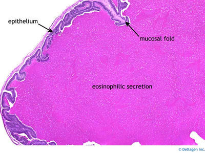 Seminal Vesicle Histology - Seminal vesicle (labels) - histology slide