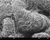 Glomerulum_of_mouse_kidney_in_Scanning_Electron_Microscope,_magnification_5,000x.gif