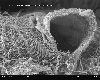 Glomerulum_of_mouse_kidney_with_broken_capillary_in_Scanning_Electron_Microscope,_magnification_10,000x.gif