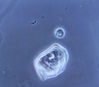 Urinary_microscopy_epithelial_cell.jpg