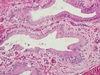 gallbladder4.jpg