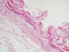 gallbladder6.jpg