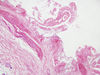gallbladder7.jpg