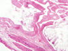 gallbladder8.jpg