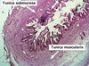 gallbladderF1.jpg