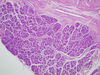 pancreas1~1.jpg