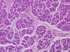 pancreas2~1.jpg