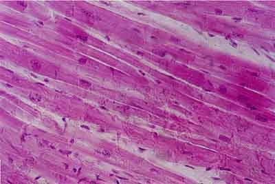 histology slide of cardiac muscle