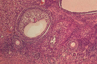 ovarian follicles slide