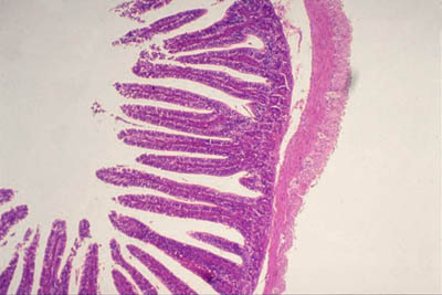 small intestine slide